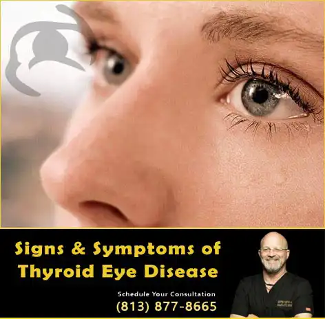 Thyroid Eyelid Disease Symptoms